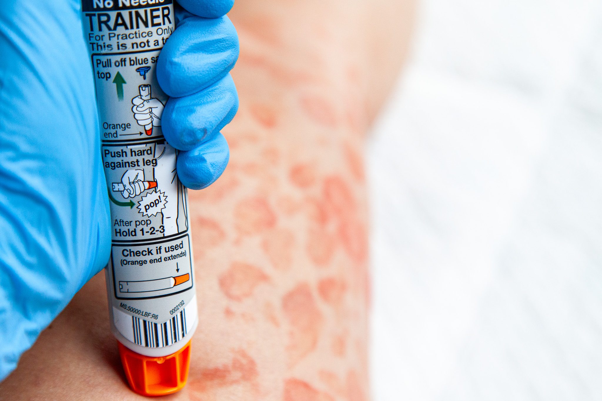 Anaphylaxis urticaria moulage applied for cabin crew scenario training
