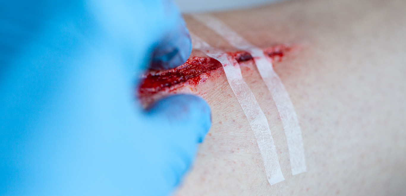 Medical simulation moulage training