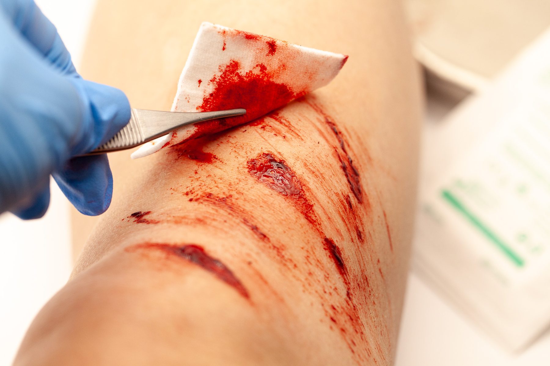 Level 1 trauma simulation moulage