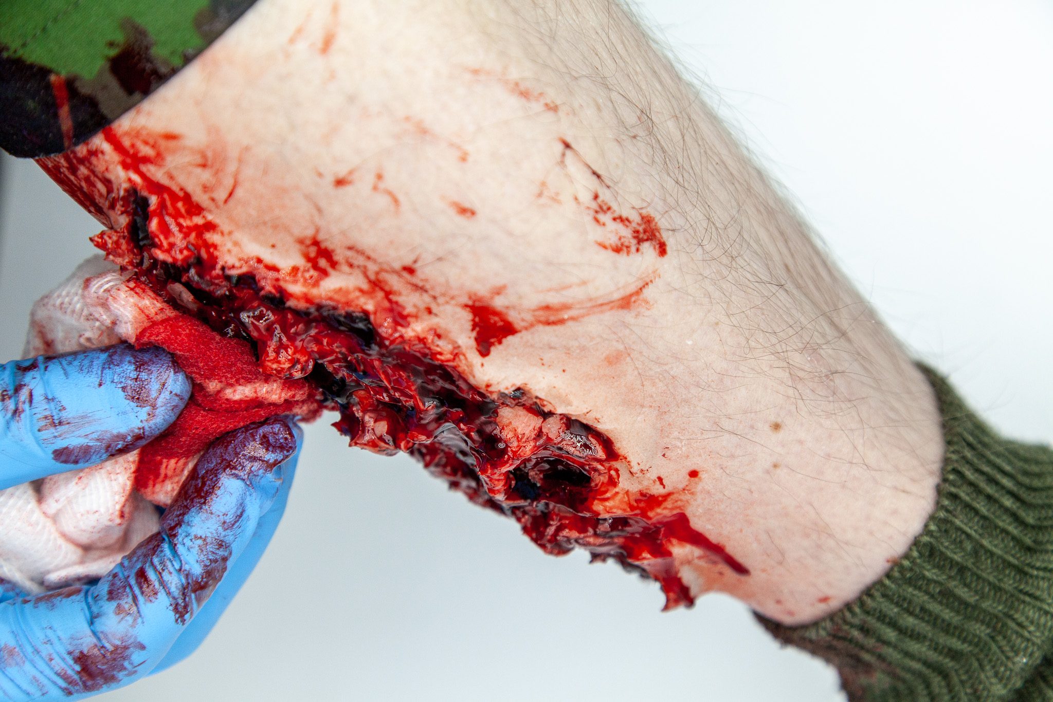 Gunshot exit wound moulage on a casualty in camouflage, clinical-grade silicone
