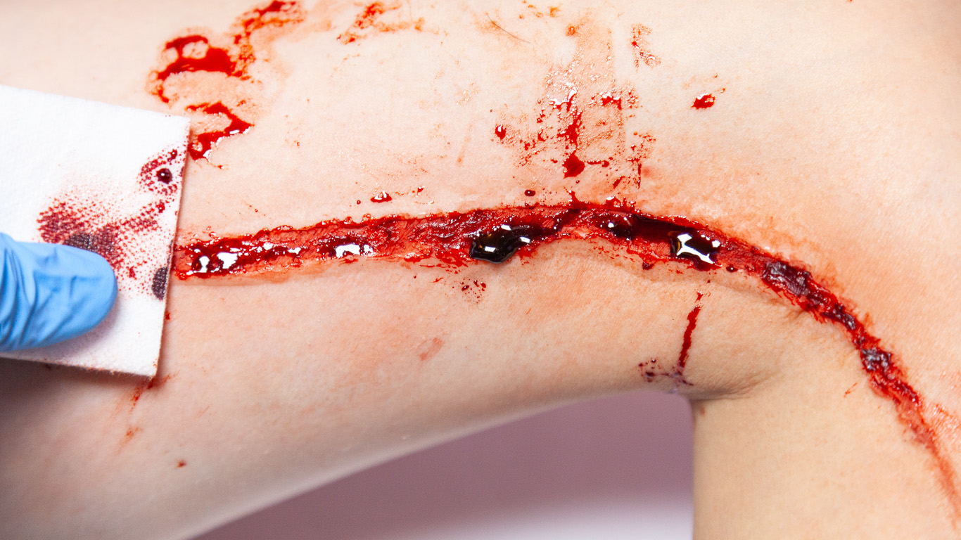 Moulage leg wound